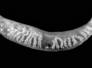 Meibomian glands in adaptive transillumination view