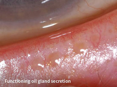 Functioning oil gland secretion