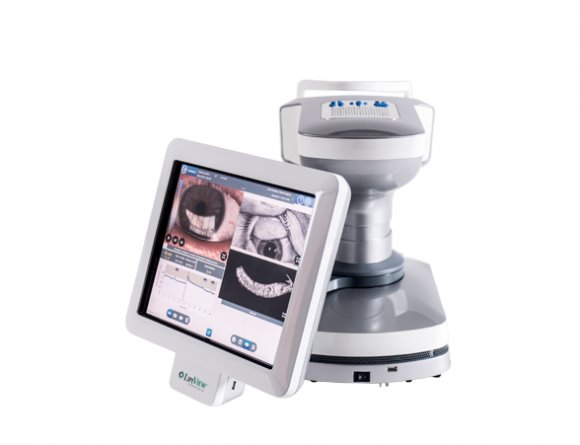 LipiView II Ocular Surface Interferometer